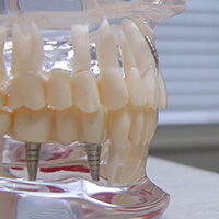 model of a human mouth